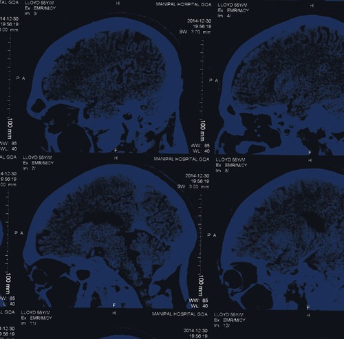 Nightingales - Mind Over Matter in der Gruppe VINYL / Rock bei Bengans Skivbutik AB (1318417)
