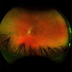 Puciato Greg - Mirrorcell (Black & Grey Splatter) in der Gruppe VINYL / Hårdrock bei Bengans Skivbutik AB (4186173)