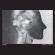 Zombi - Direct Inject Zombi - Direct Inject